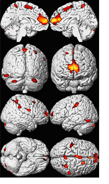 Brain Scan, LEAD